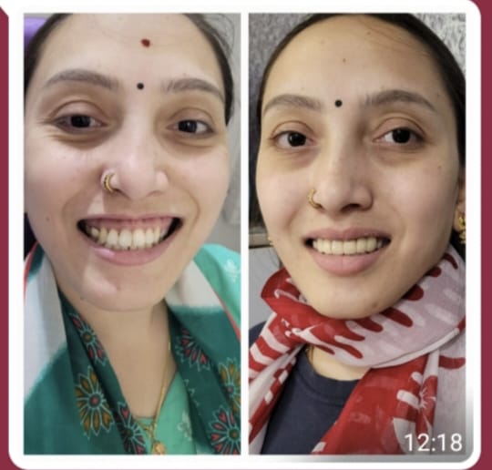 The Importance of Regular Dental Check-ups: Your Path to Optimal Oral Health